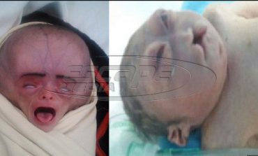 Σοβαρές παραμορφώσεις από τον πόλεμο στην Υεμένη
