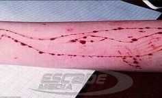 «ΜΠΛΕ ΦΑΛΑΙΝΑ»! Νέο κρούσμα στην Τούμπα με θύμα 14χρονη