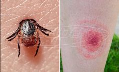 Νόσος του Lyme (βορρελίωση)