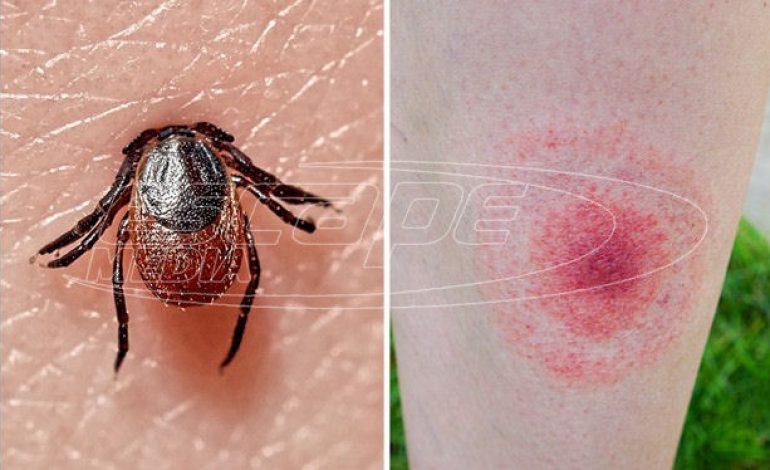 Νόσος του Lyme (βορρελίωση)